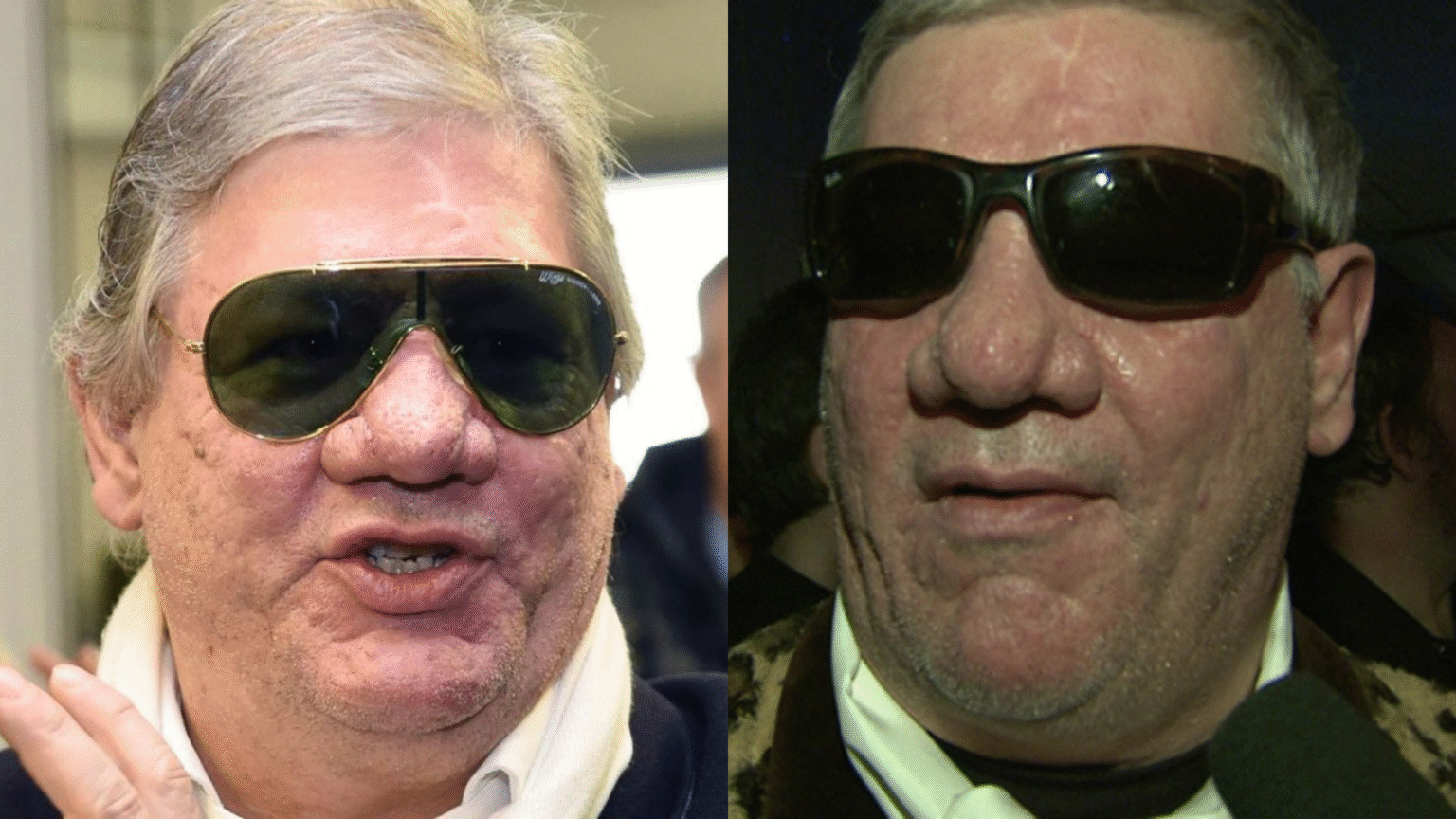 Claude-Oliver Rudolph Nase Krankheit – Fakten & Gerüchte erklärt claude-oliver rudolph nase krankheit